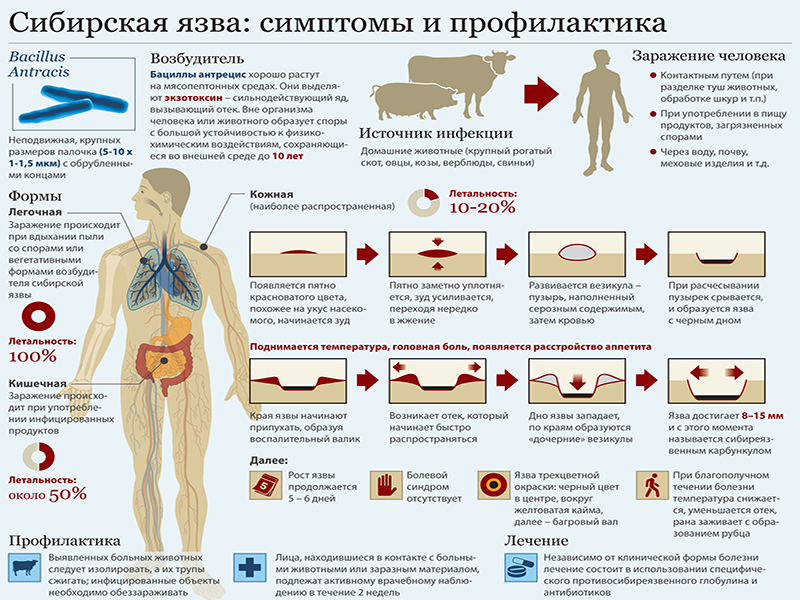 Сибирская язва профилактика.